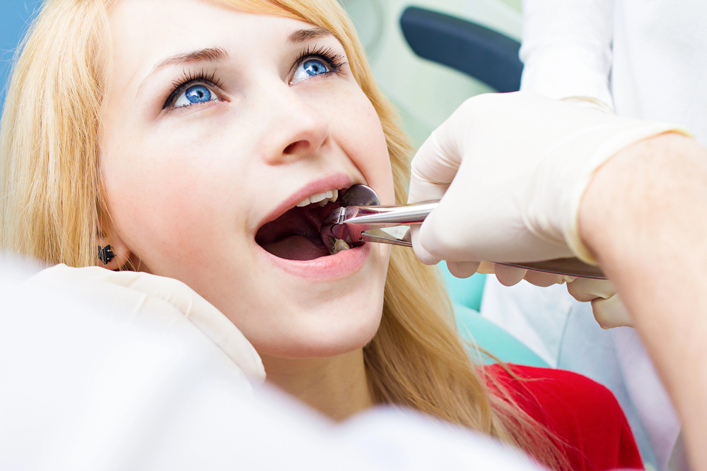 Reabilitação Oral: Análise Completa de Custo-Benefício 4 Extracao do dente siso